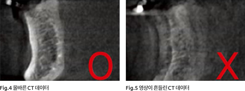 CT 촬영 시 주의사항 이미지