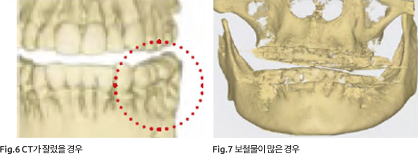 CT장비의 FOV size 확인 이미지